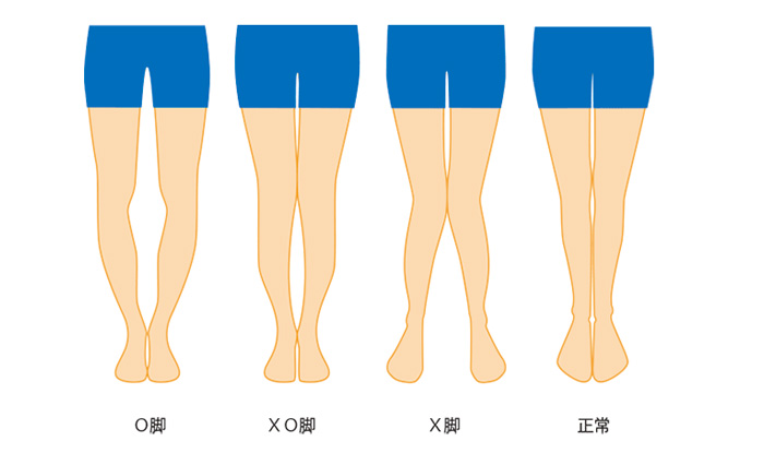 股関節のO脚は『身体の歪み』と『普段の姿勢』が原因
